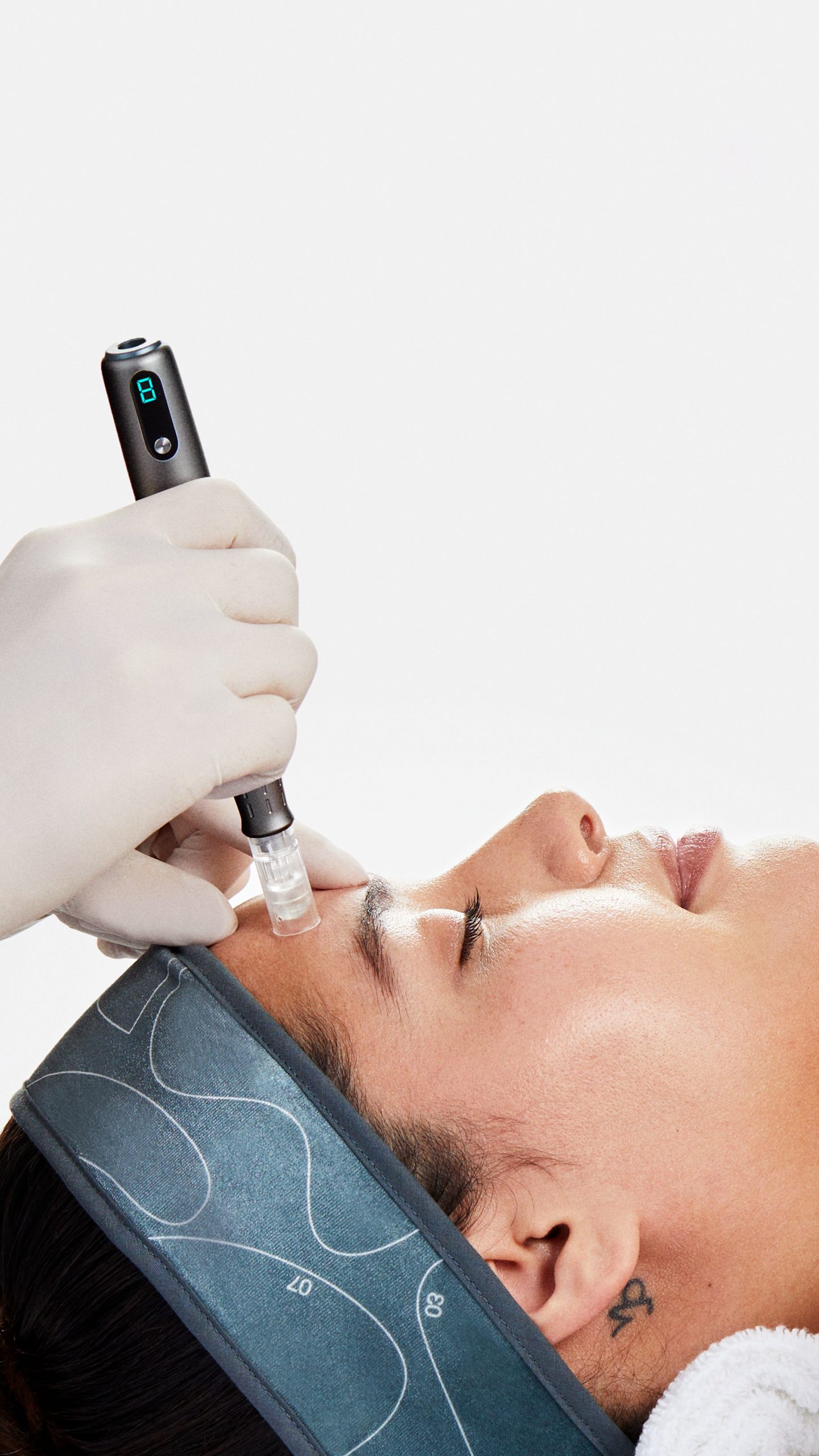 9x16 Microneedling - Model 3